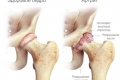 Artritis pri psih: zdravljenje